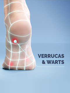 Scholl Verrucas & Warts